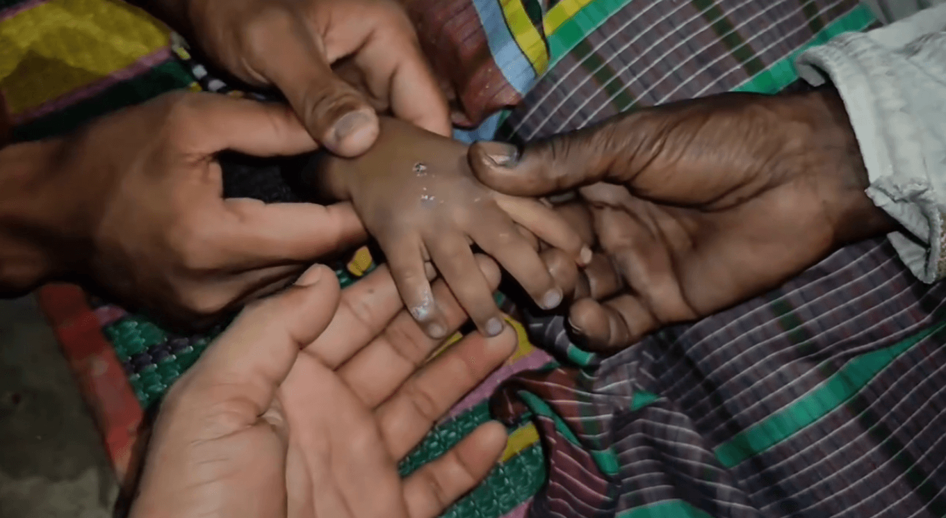 সিরাজগঞ্জে সাপের কামড়ে ৩ বছরের শিশুর মৃত্যু